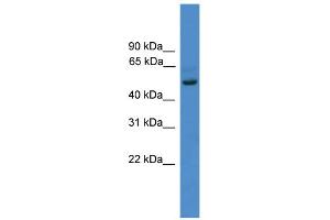 WB Suggested Anti-ZNF277 Antibody Titration:  0.