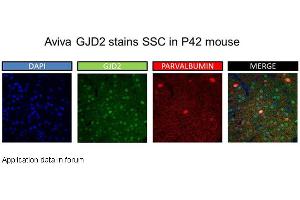 Image no. 2 for anti-Gap Junction Protein, delta 2, 36kDa (GJD2) (Middle Region) antibody (ABIN2774866)