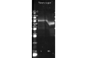 Image no. 2 for anti-Plasminogen (PLG) antibody (ABIN105702)