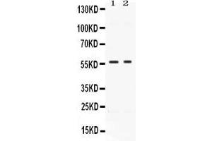 anti-Bone Morphogenetic Protein 15 (BMP15) (AA 268-392) antibody