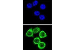 Image no. 2 for anti-Poly (ADP-Ribose) Polymerase 1 (PARP1) (AA 183-214) antibody (ABIN3032164)