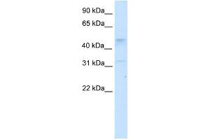 Image no. 1 for anti-Transcription Factor AP-2 gamma (Activating Enhancer Binding Protein 2 Gamma) (TFAP2C) (N-Term) antibody (ABIN2778628)