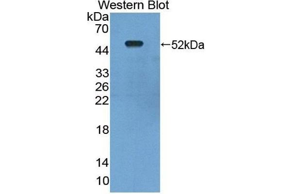 LDHD antibody  (AA 62-265)
