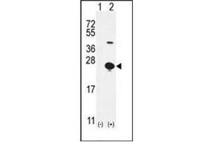 Image no. 1 for anti-Epithelial Mitogen (EPGN) (AA 31-59), (N-Term) antibody (ABIN952095)