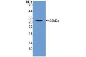 Detection of Recombinant iPLA2, Human using Polyclonal Antibody to Phospholipase A2, Calcium Independent (iPLA2)