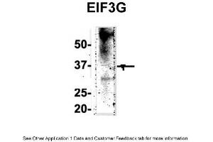 Image no. 2 for anti-Eukaryotic Translation Initiation Factor 3, Subunit G (EIF3G) (Middle Region) antibody (ABIN2778865)