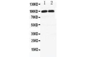 Image no. 4 for anti-Discs, Large Homolog 4 (Drosophila) (DLG4) (AA 492-507), (C-Term) antibody (ABIN3044479)