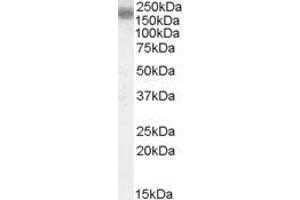 Image no. 2 for anti-Low Density Lipoprotein Receptor-Related Protein 4 (LRP4) (Internal Region) antibody (ABIN308424)