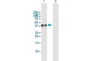 Image no. 2 for anti-Endonuclease 8-like 2 (NEIL2) (AA 1-332) antibody (ABIN531426)