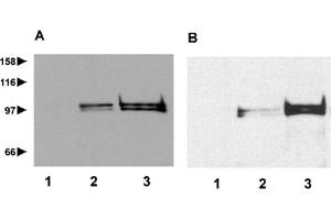 Image no. 2 for anti-Repetin (RPTN) (AA 570-584) antibody (ABIN1169384)
