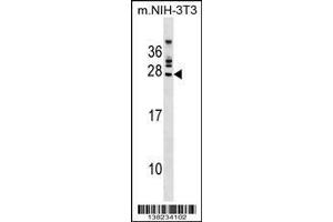 Image no. 1 for anti-FGFR1 Oncogene Partner 2 (FGFR1OP2) (AA 140-166) antibody (ABIN1537851)