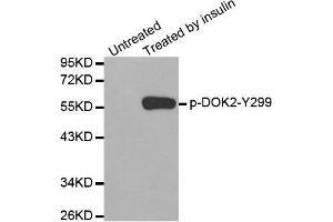 Image no. 1 for anti-DOK2 (DOK2) (pTyr299) antibody (ABIN3019935)
