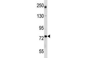 Image no. 3 for anti-Glutamate-Cysteine Ligase, Catalytic Subunit (GCLC) (AA 286-315) antibody (ABIN3031077)
