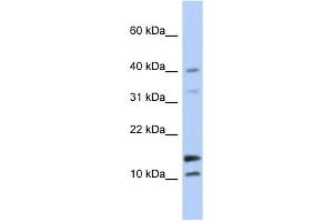 Image no. 1 for anti-WAP Four-Disulfide Core Domain 5 (WFDC5) (N-Term) antibody (ABIN633949)