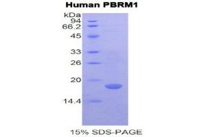Image no. 1 for Polybromo 1 (PBRM1) (AA 957-1086) protein (His tag) (ABIN1981204)