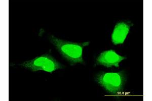 Image no. 3 for anti-Musashi Homolog 1 (Drosophila) (MSI1) (AA 1-87) antibody (ABIN518033)
