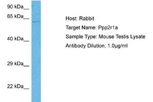 Image no. 1 for anti-Protein Phosphatase 2, Regulatory Subunit A, alpha (PPP2R1A) (N-Term) antibody (ABIN2774161)