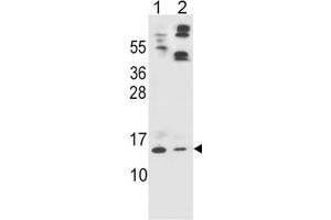 Image no. 1 for anti-Apolipoprotein C-II (APOC2) (AA 45-73), (Center) antibody (ABIN1981367)