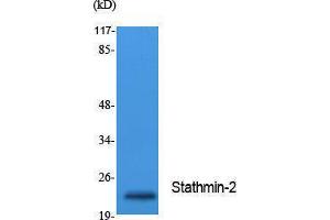 anti-Stathmin-Like 2 (STMN2) (Internal Region) antibody