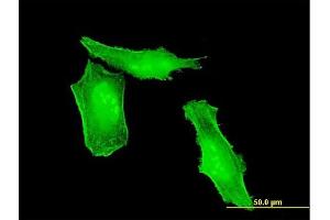 Immunofluorescence of monoclonal antibody to HRSP12 on HeLa cell.