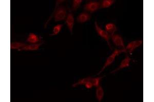 HDAC5 antibody  (C-Term)
