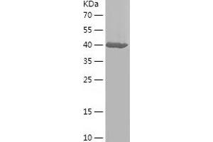 CEMIP Protein (AA 37-218) (IF2DI tag)
