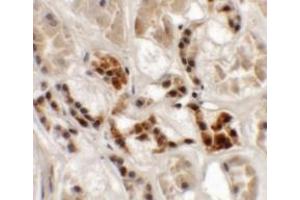 Immunohistochemistry (IHC) image for anti-Adaptor-Related Protein Complex 3, sigma 1 Subunit (AP3S1) (Middle Region) antibody (ABIN1030856)