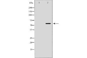 Image no. 3 for anti-Monoamine Oxidase B (MAOB) (Internal Region) antibody (ABIN6263092)