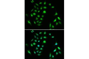 Image no. 2 for anti-conserved Helix-Loop-Helix Ubiquitous Kinase (CHUK) antibody (ABIN3022825)