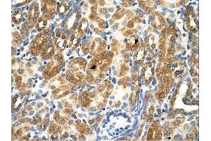 Image no. 1 for anti-MAS1 Oncogene (MAS1) (Middle Region) antibody (ABIN635593)