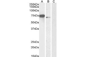 Image no. 1 for anti-Forkhead Box C1 (FOXC1) (C-Term) antibody (ABIN185028)