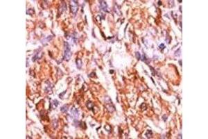 Image no. 3 for anti-Retinoblastoma Protein (Rb Protein) (pSer811) antibody (ABIN3029756)
