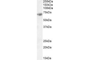 Image no. 2 for anti-IL2-Inducible T-Cell Kinase (ITK) (Internal Region) antibody (ABIN1589997)