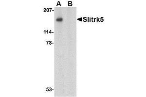 Image no. 1 for anti-SLIT and NTRK-Like Family, Member 5 (SLITRK5) (Internal Region) antibody (ABIN1493806)