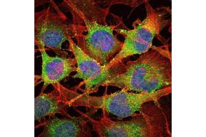 Image no. 1 for anti-SMAD, Mothers Against DPP Homolog 2 (SMAD2) antibody (ABIN1845454)