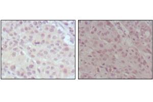 Image no. 1 for anti-Myeloid/lymphoid Or Mixed-Lineage Leukemia (MLL) (AA 3751-3968) antibody (ABIN1108254)