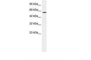 Image no. 2 for anti-Meis Homeobox 2 (MEIS2) (AA 50-99) antibody (ABIN202623)