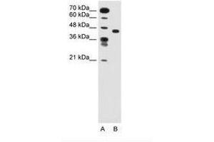 Image no. 1 for anti-Solute Carrier Family 35, Member C1 (SLC35C1) (AA 51-100) antibody (ABIN205019)