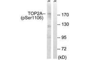 Western blot analysis of extracts from Jurkat cells treated with paclitaxel 1uM 24h, using TOP2A (Phospho-Ser1106) Antibody.