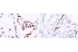 Image no. 3 for anti-Heterogeneous Nuclear Ribonucleoprotein A1 (HNRNPA1) antibody (ABIN108609)