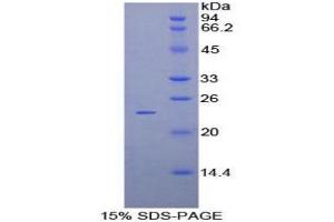 Image no. 1 for Protocadherin beta 2 (PCDHb2) protein (ABIN3011392)