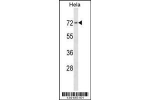 Image no. 1 for anti-Protein Kinase C Substrate 80K-H (PRKCSH) (AA 6-35), (N-Term) antibody (ABIN1539431)