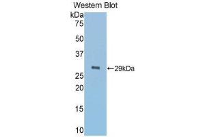 Image no. 1 for anti-alpha-1-B Glycoprotein (A1BG) (AA 220-415) antibody (ABIN1857837)