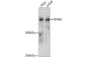 Image no. 1 for anti-E1A Binding Protein P400 (EP400) antibody (ABIN6567352)