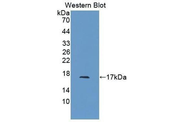 anti-Activin A Receptor, Type IIB (ACVR2B) (AA 214-350) antibody