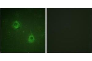 Immunofluorescence analysis of COS7 cells, using APC1 (Phospho-Ser688) Antibody.