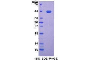 Image no. 1 for S100 Protein (S100) (AA 1-94) protein (His tag,GST tag) (ABIN2123566)