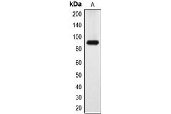 DYRK1A 抗体  (N-Term)