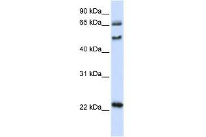 Image no. 1 for anti-UNC Homeobox (UNCX) (N-Term) antibody (ABIN2783014)