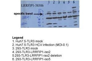 Image no. 2 for anti-Leucine Rich Repeat (In FLII) Interacting Protein 1 (LRRFIP1) (N-Term) antibody (ABIN2780614)